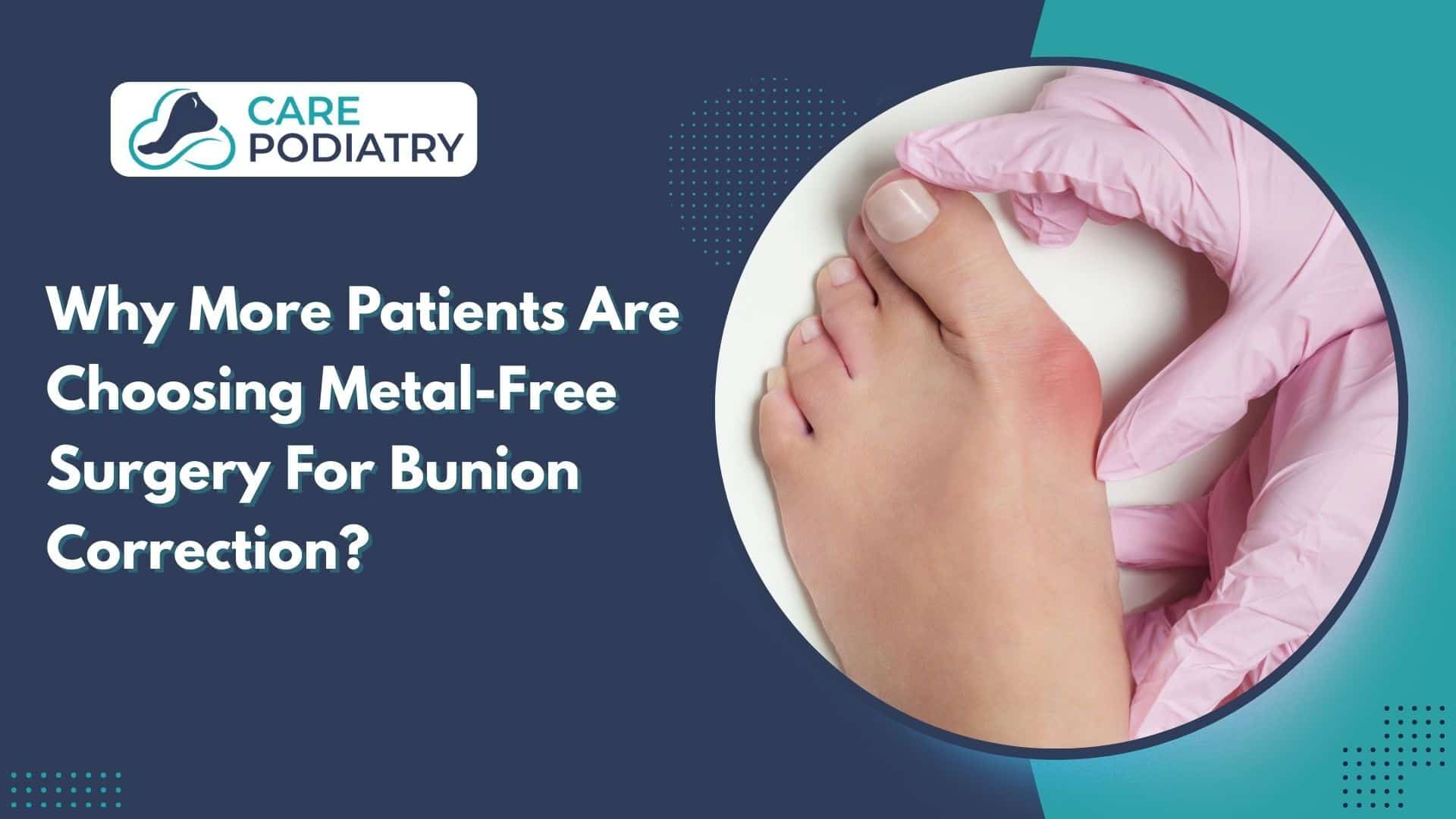 Why More Patients Are Choosing Metal-Free Surgery For Bunion Correction