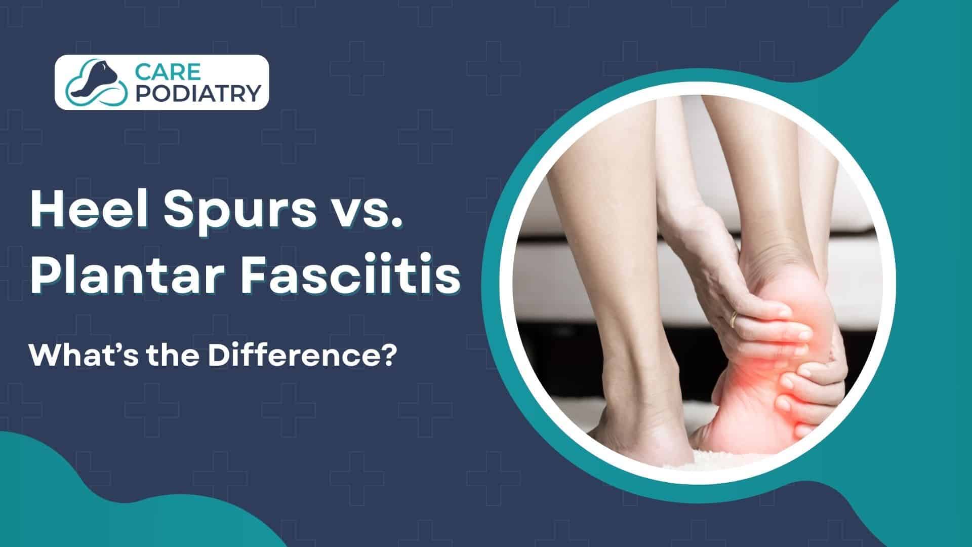 Heel Spurs vs. Plantar Fasciitis - What’s the Difference