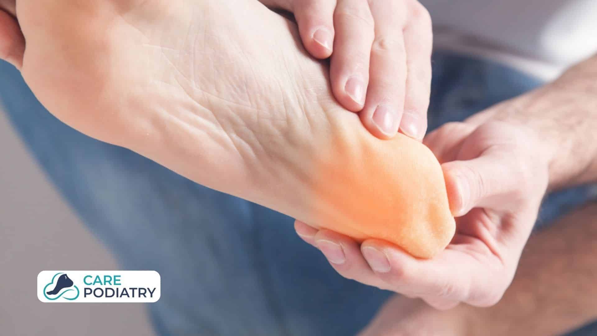 Heel spur