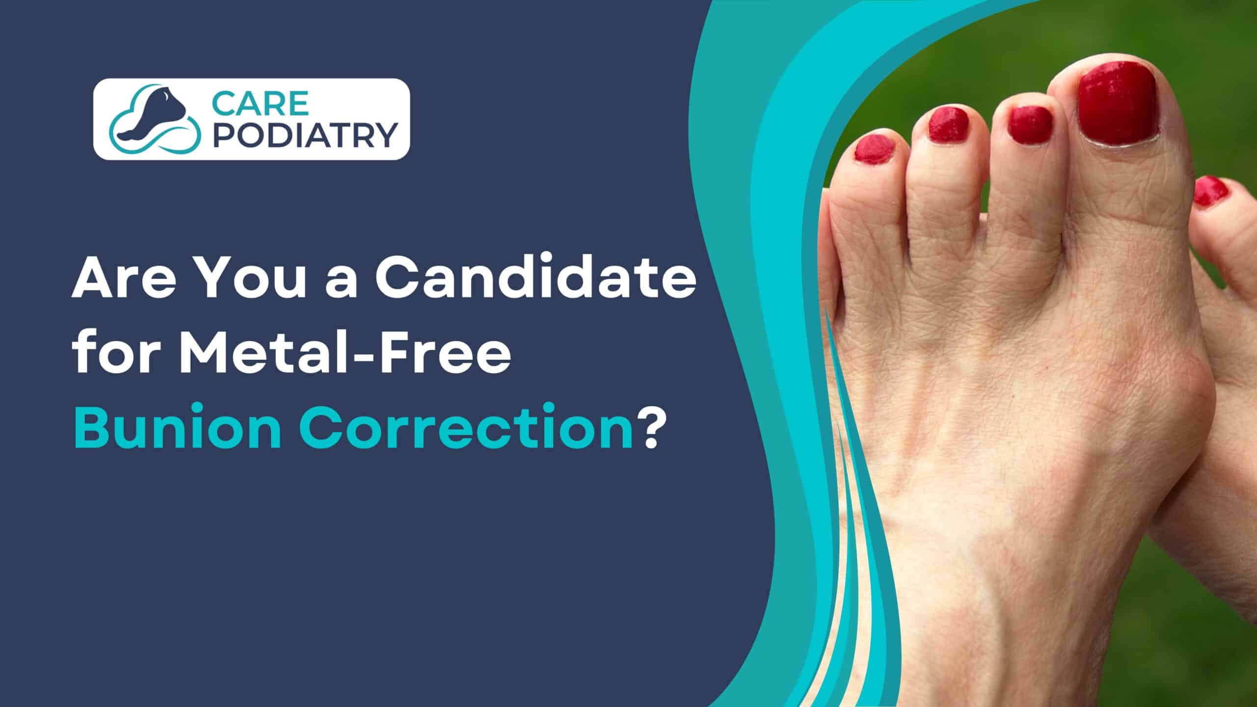 Are You a Candidate for Metal-Free Bunion Correction