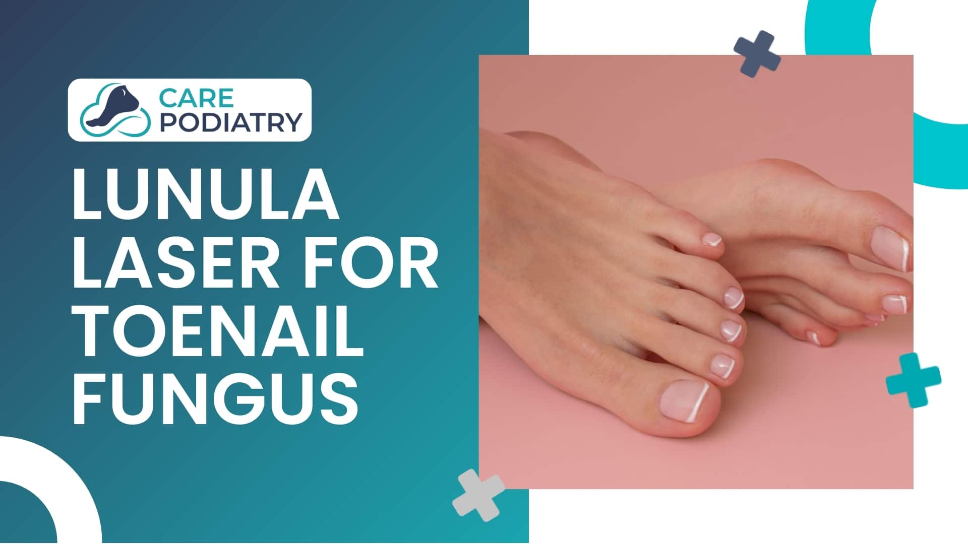 Lunula Laser for Toenail Fungus by Care Podiatry