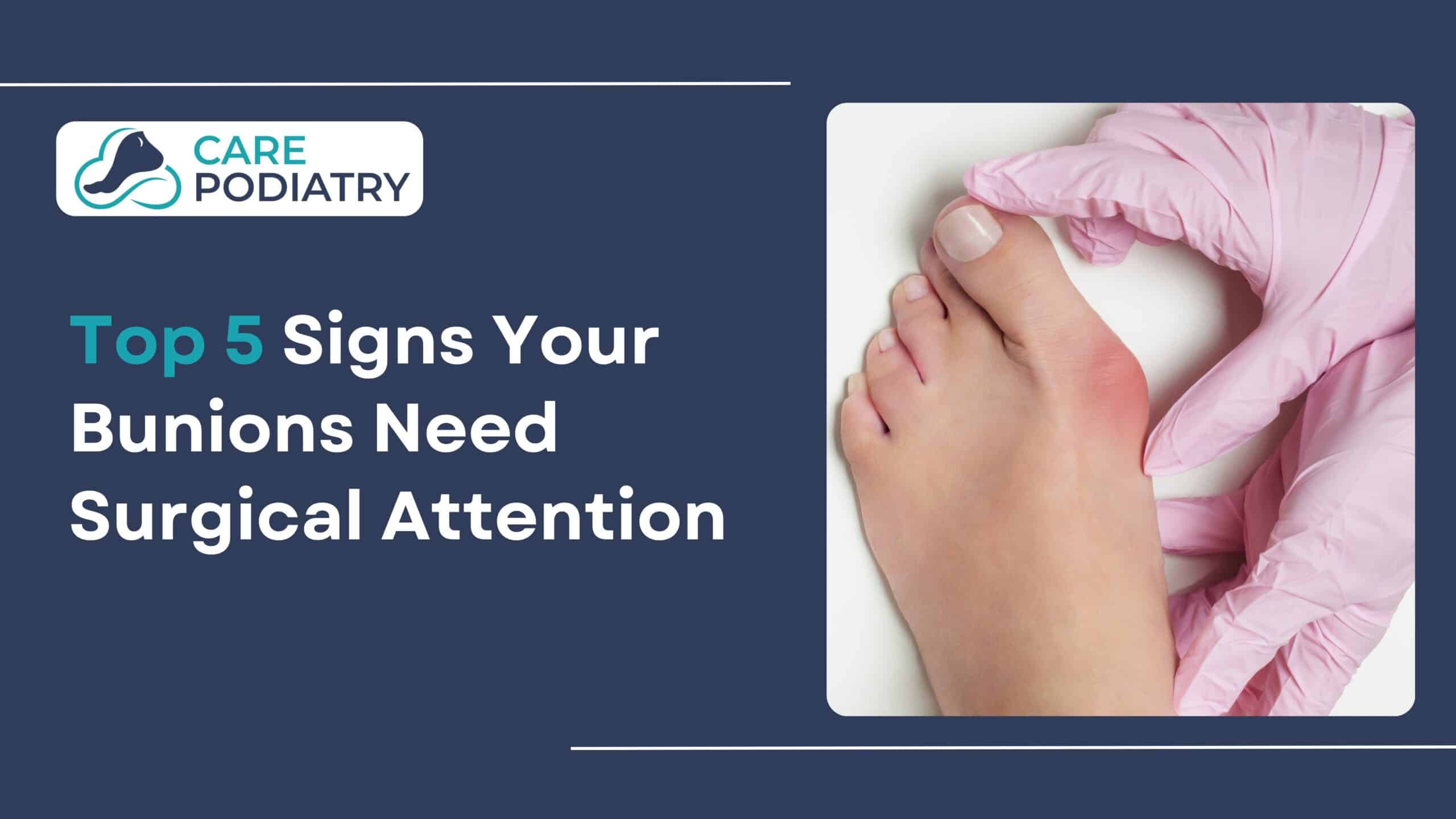 Top 5 Signs Your Bunions Need Surgical Attention